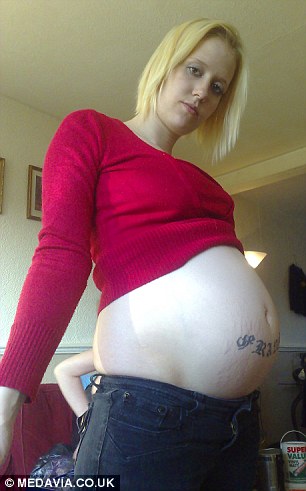 英国一女士患巨结肠病腹部肿大好似怀孕（图）