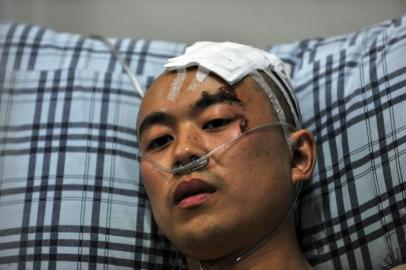 2011年8月21日，头部受伤的陈涛躺在病床上。本报资料图片