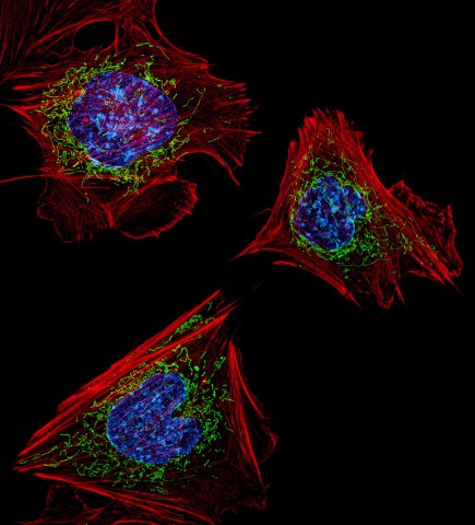 第五名：鼠胚胎成纤维细胞展示肌动蛋白微丝(红色)与DNA (蓝色)。