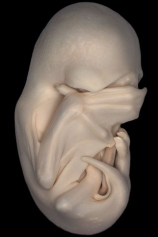第二名：黑獒蝙蝠胚胎的侧面图。